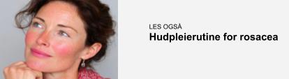 Denne banneren linker til et innlegg med hudpleieråd for rosacea
