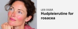 Banner som linker til artikkel om hudpleierutine for rosacea