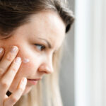 Hudpleie etter isotretinoin