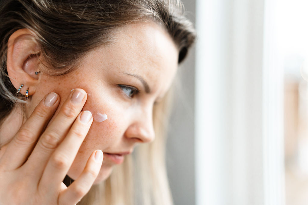 Hudpleie etter isotretinoin