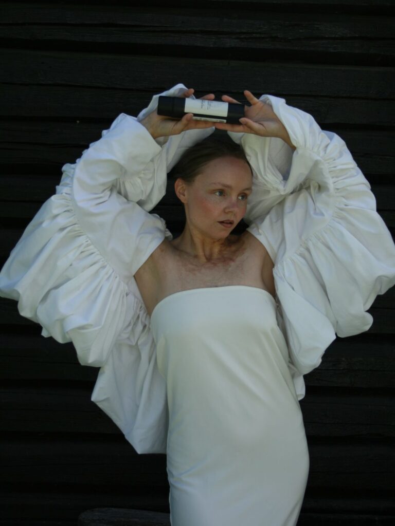 Tine linnea poserer i eget sydd antrekk med favn extra nourishing cream som hun bruker på brannskaden sin